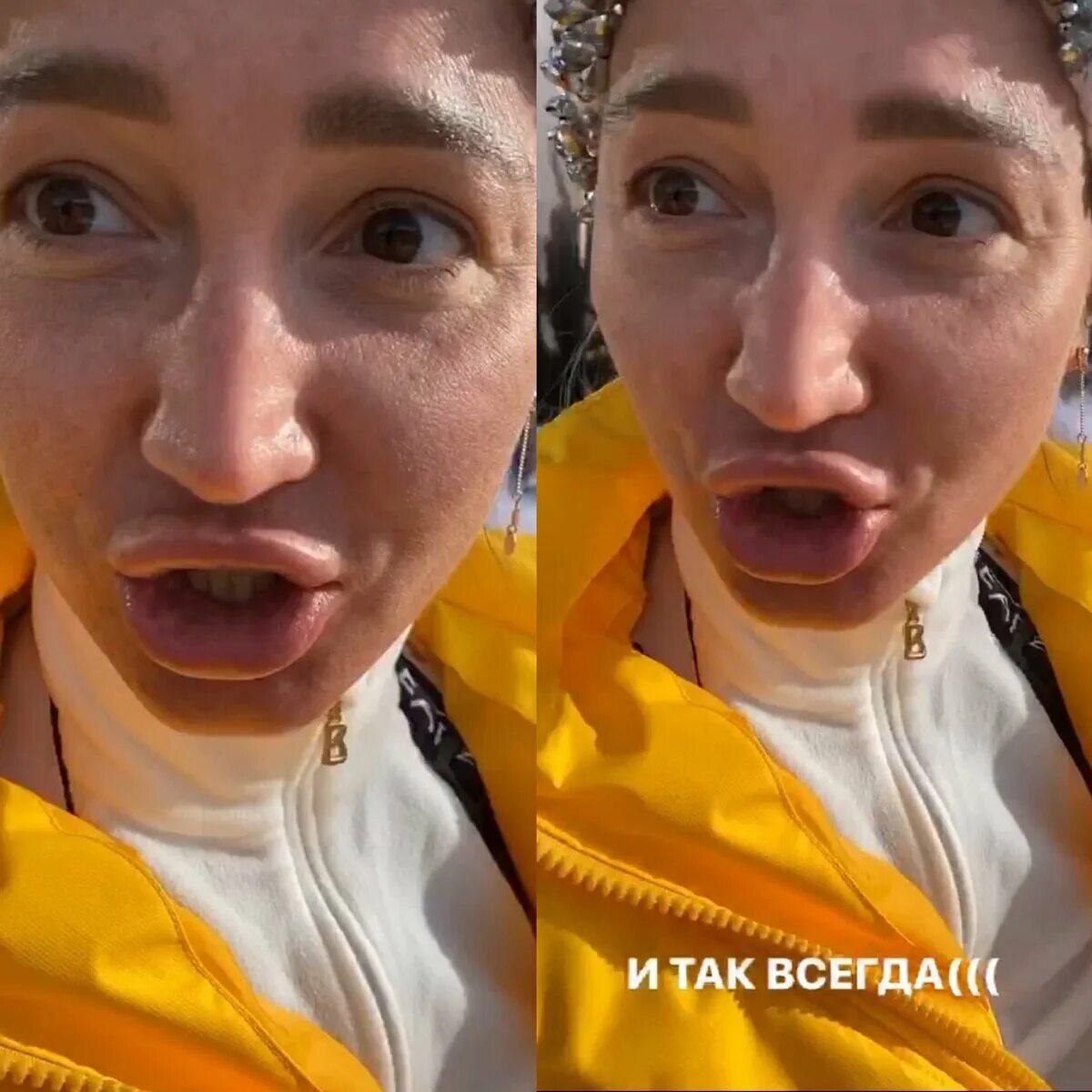 Уставший и болезненный вид: Ольгу Бузову без макияжа и фильтров не узнали поклон