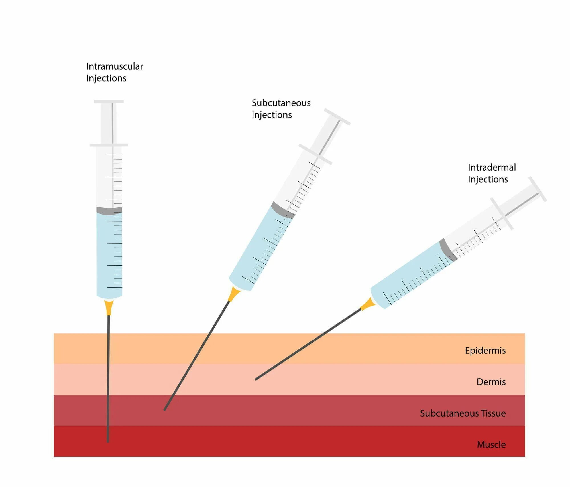 Method injection