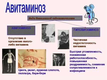 Лепские авитаминозы