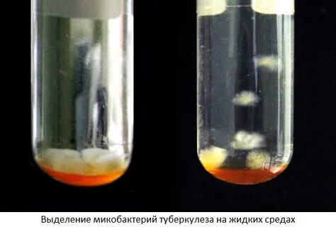 Среда для микобактерий туберкулеза