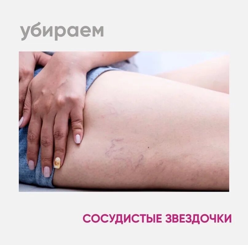 Как выглядят звездочки на ногах luaeva: фотографії, зображення, ресурси Adobe Stock