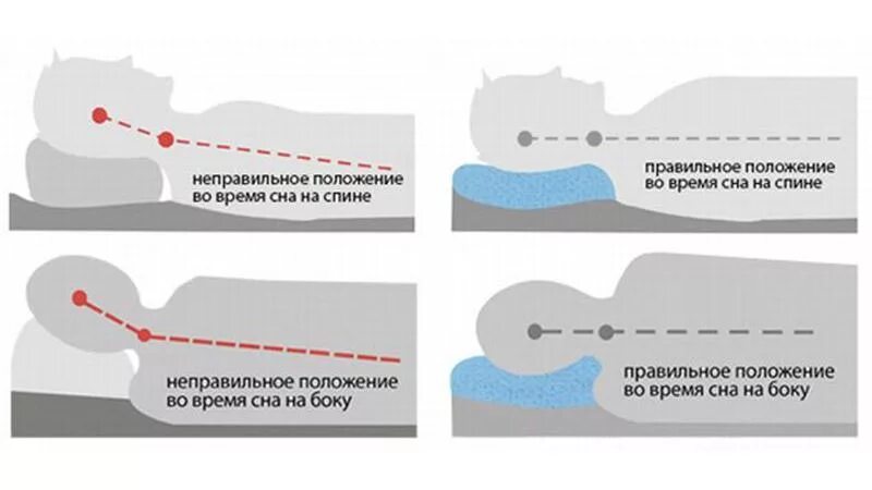 Спина позвоночник. Человек лежит на кровати. Затекает спина во сне. Девушка лежит на подушке. Девушка спит закинув руку за голову.