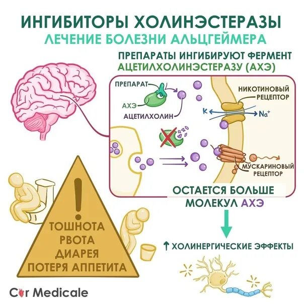 Болезнь альцгеймера препараты. Болезнь Альцгеймера. Альцгеймера препараты. Таблетки от болезни Альцгеймера. Терапия болезни Альцгеймера.