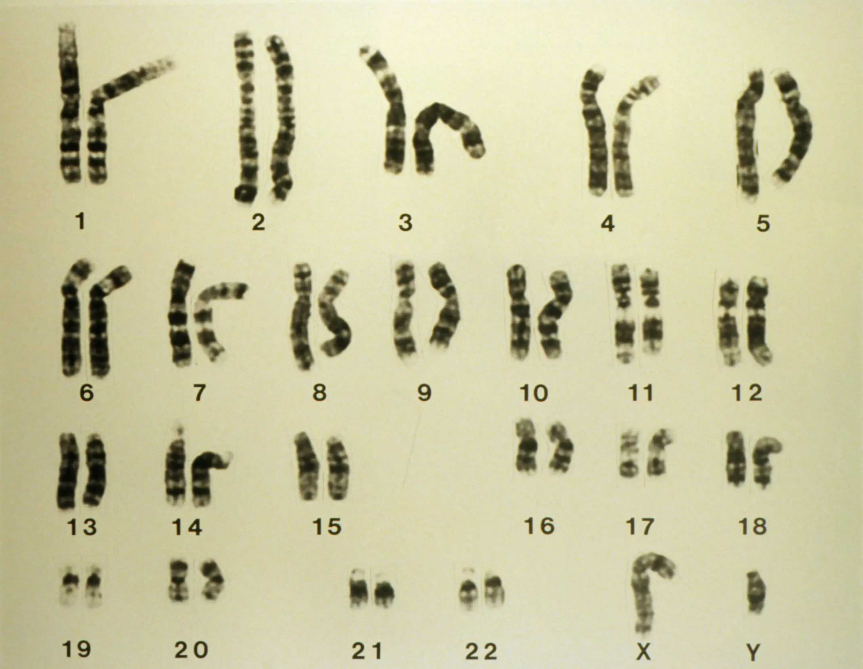 Гомозиготная и гетерозиготная хромосома. Гетерозиготная мутация что это. Хромосомы лошади. Гомозиготный набор хромосом. Мужская хромосома 5