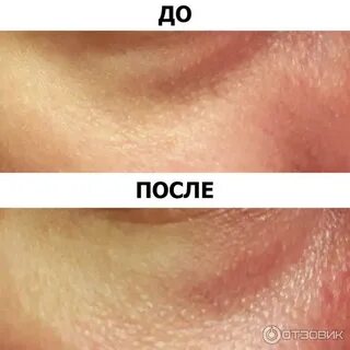 Ready skin nano skin