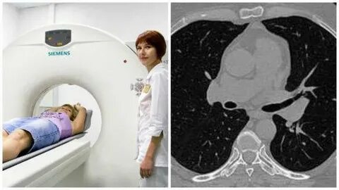 Кт легких как проводится процедура