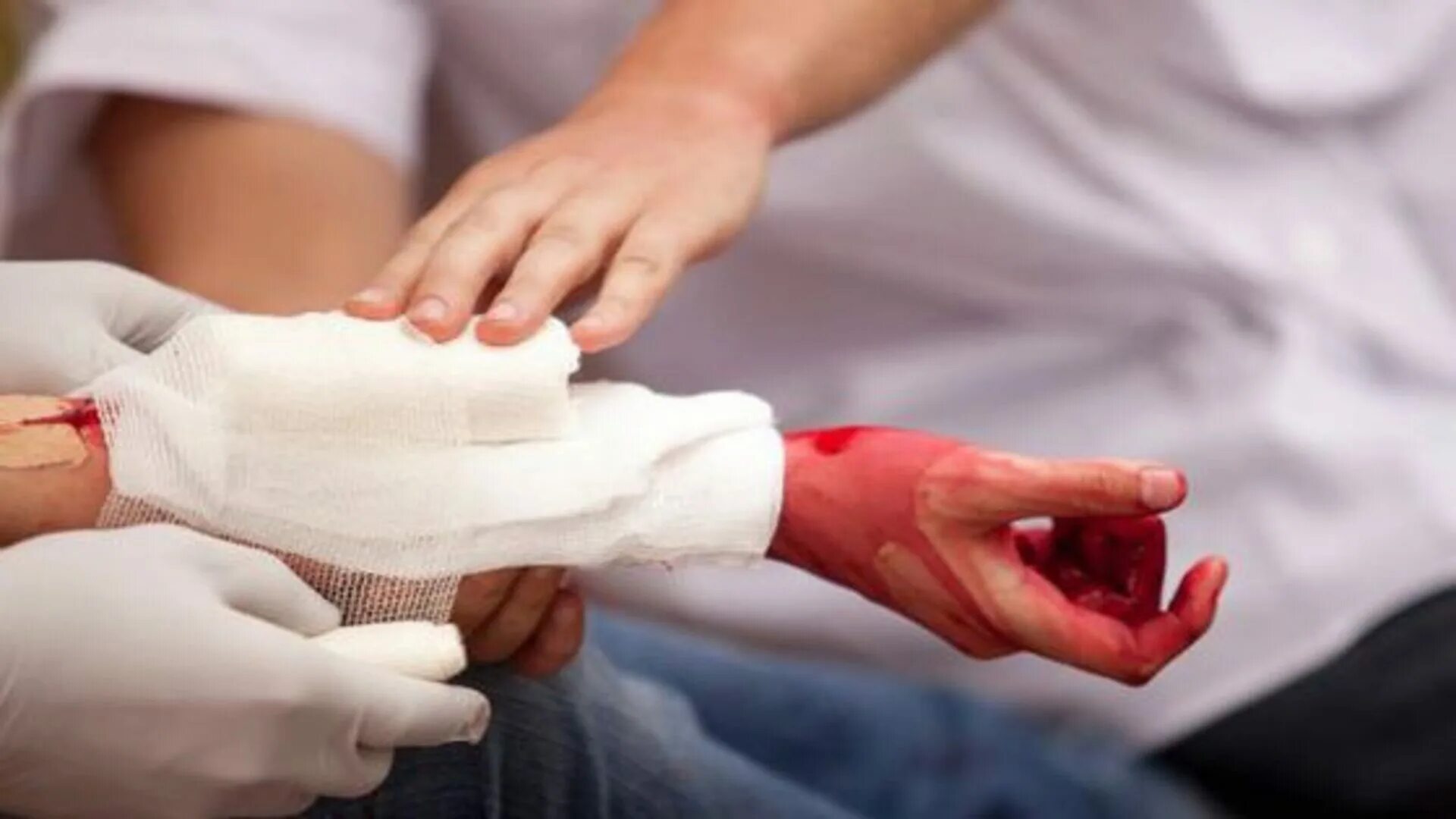 First aid bleeding. First aid bleeding