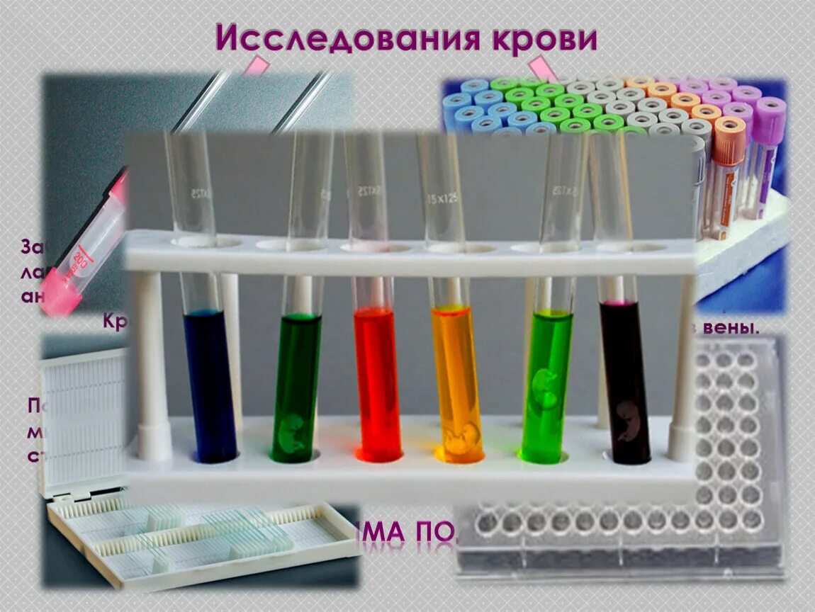 Методики забора для лабораторных исследований. Забор биологического материала для лабораторного исследования. лабораторные методы исследования крови животных. забор биологического материала для бак исследований. общий анализ крови лабораторная посуда.