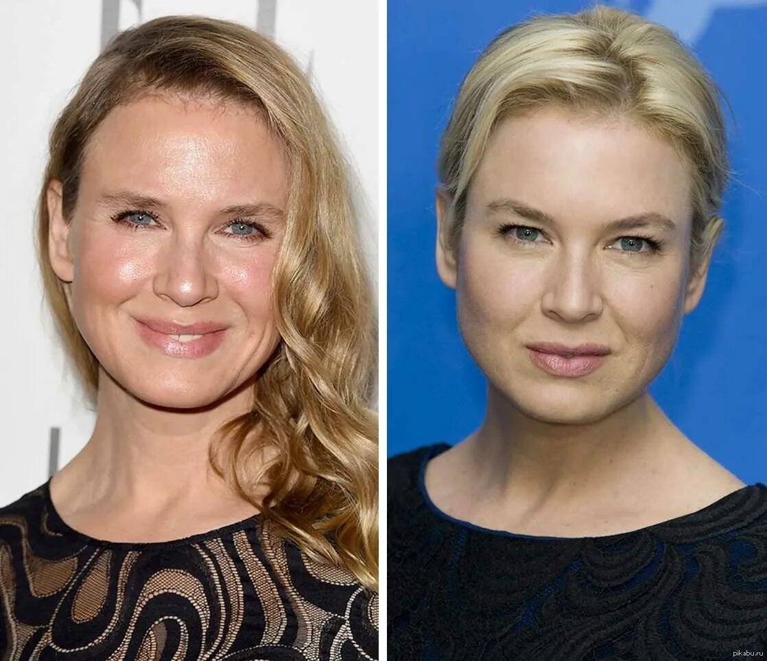 Рене зеллвегер пластика. Рене зеллвегер до пластики. Рене зеллвегер после пластики. Рене зеллвегер после пластики. Рене зельвегер операции.
