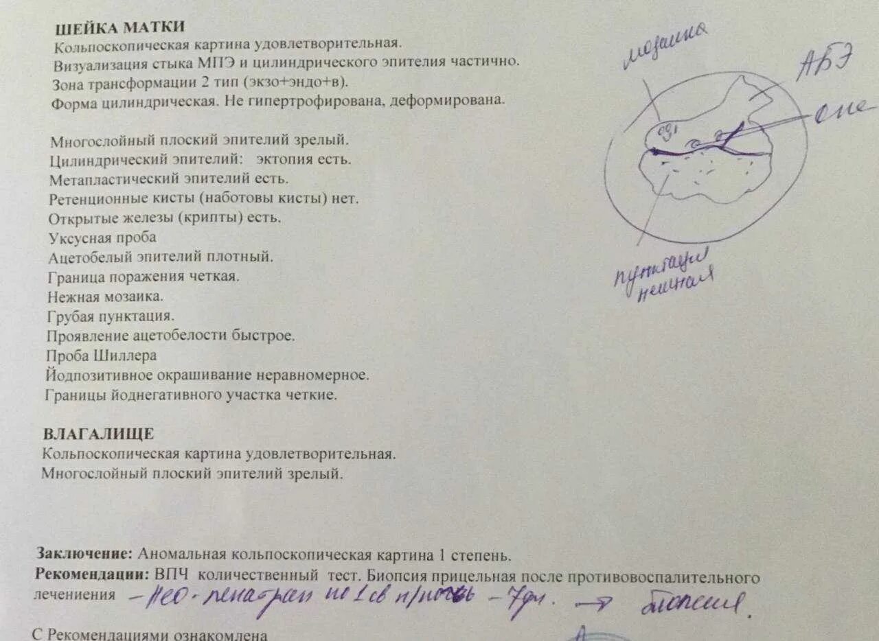 После биопсии матки. Протокол кольпоскопии. заключение биопсии шейки матки. заключение кольпоскопии. кольпоскопия заключение.