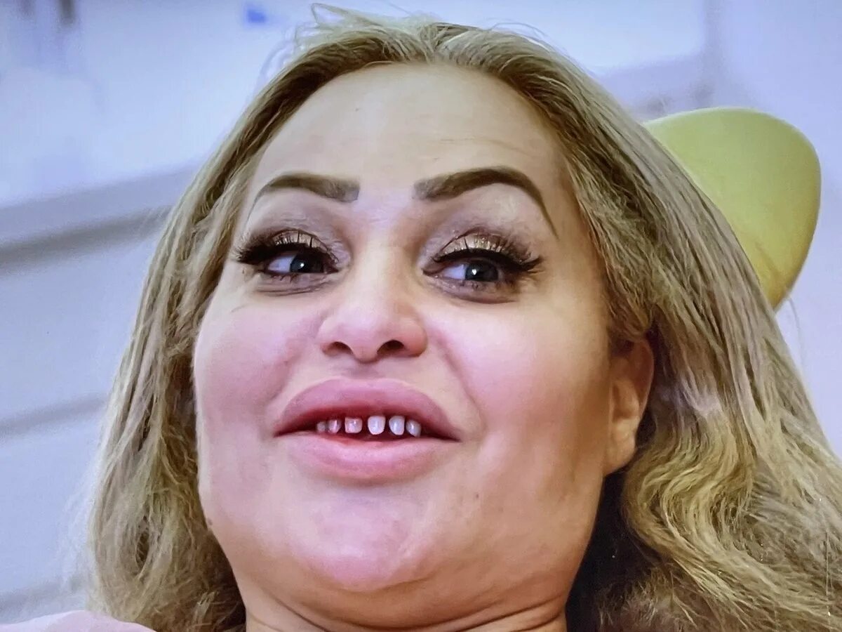 Тлс прямой эфир