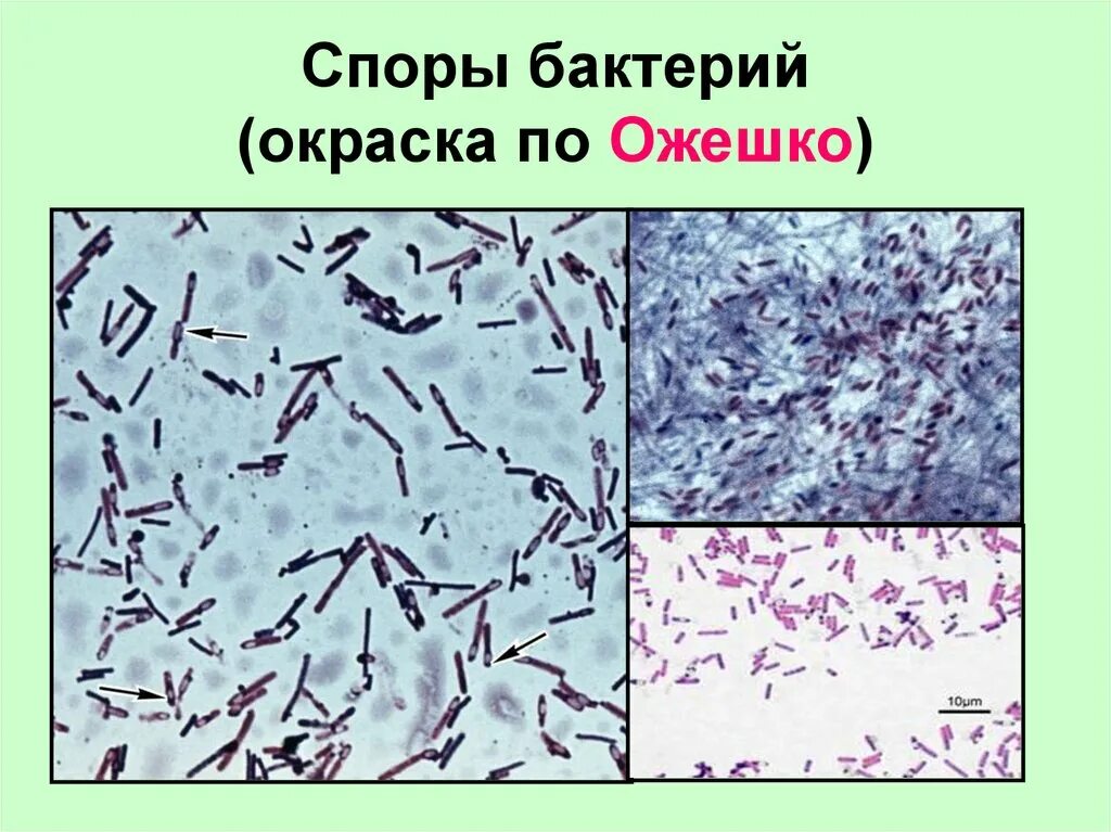 Окраска спор бактерий. Споры бацилл окрашенные по Ожешко. Окраска по методу Ожешко клостридии. Окраска бактериальных спор клостридий. Метод окраски спор бактерий Ожешко.