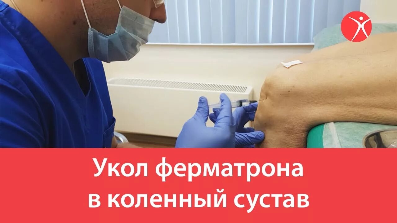 Укол в коленный сустав Ферматрон. Укол ферматрона в коленный сустав. Внутрисуставные инъекции в коленный сустав. Введение ферматрона в коленный сустав.