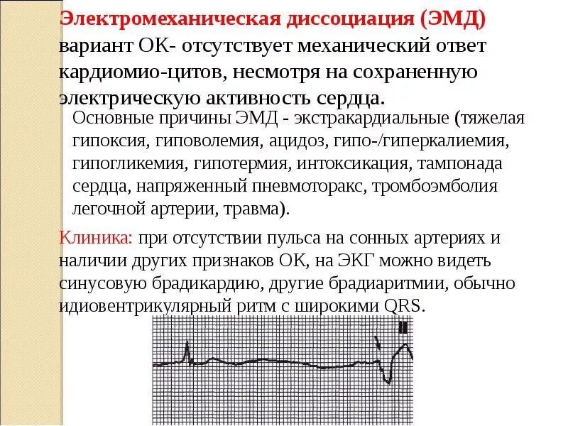 ЭКГ при электромеханической диссоциации сердца. Клинические признаки электромеханической диссоциации на ЭКГ. Электромеханическая диссоциация на ЭКГ. ЭКГ асистолия и электромеханическая диссоциация. Варианты остановки кровообращения