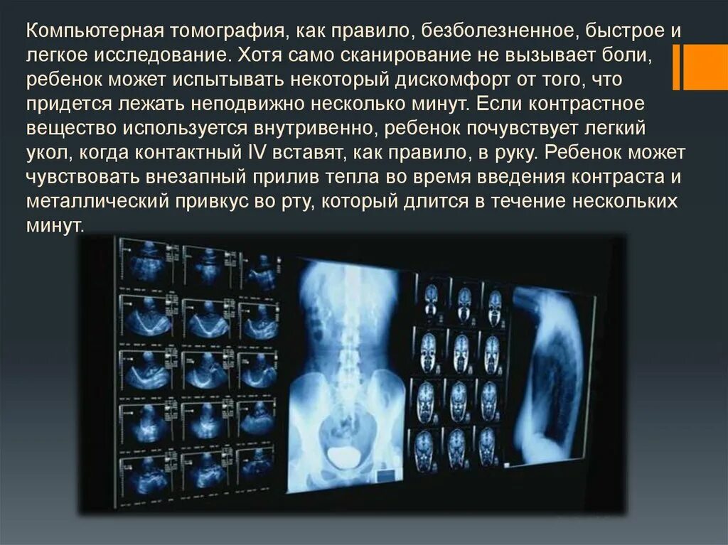 Можно пить после мрт. Томография. Подготовка к томографии. Показания для проведения компьютерной томографии. Компьютерная томография брюшной полости подготовка.