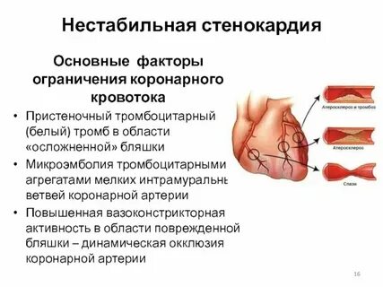 Нестабильность гемодинамики