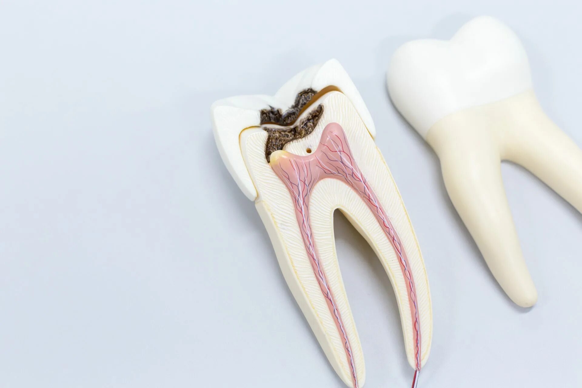 Root canal. Строение зуба кариес пульпит.