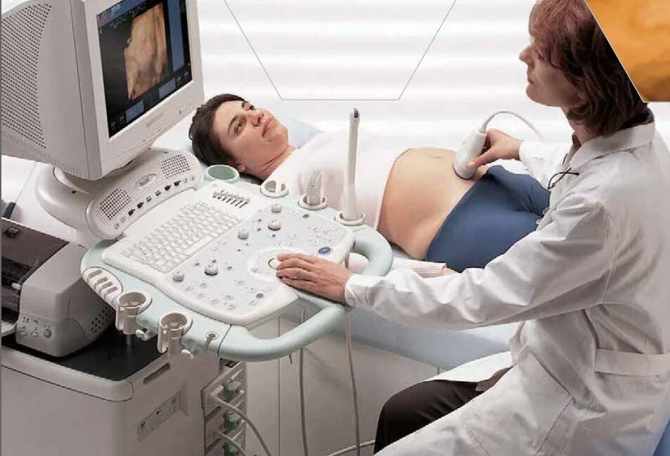 В год какие узи делают. Аппарат УЗИ для беременных. Прибор для скрининга. Скрининг аппарат. УЗИ беременных.