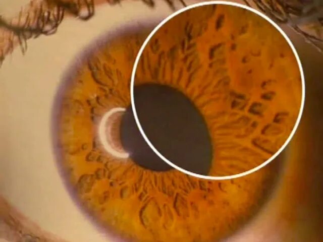Радужки глаз иридодиагностика. Иридодиагностика карие глаза. Иридодиагностика кишечника. Иридодиагностика лимб радужной. Определить на глазок