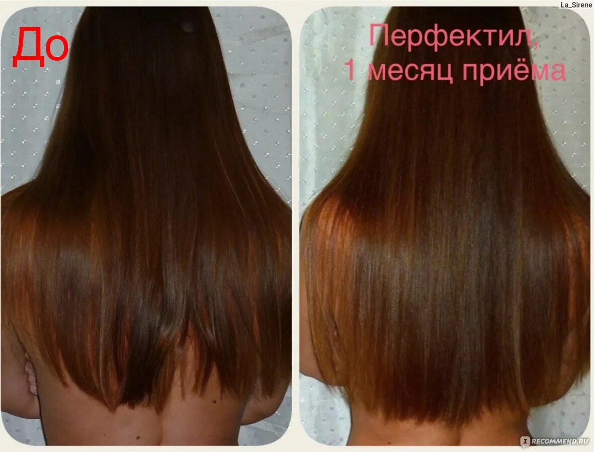 Пантенол волосы до и после Пантенол который мы используем при ожогах творит чудеса с волосами! Б � здоровье