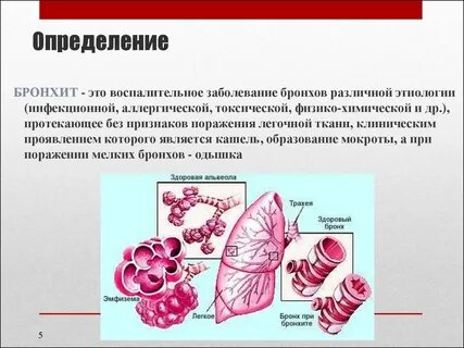 Патогенез бронхита
