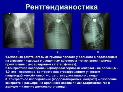Отсутствие полости