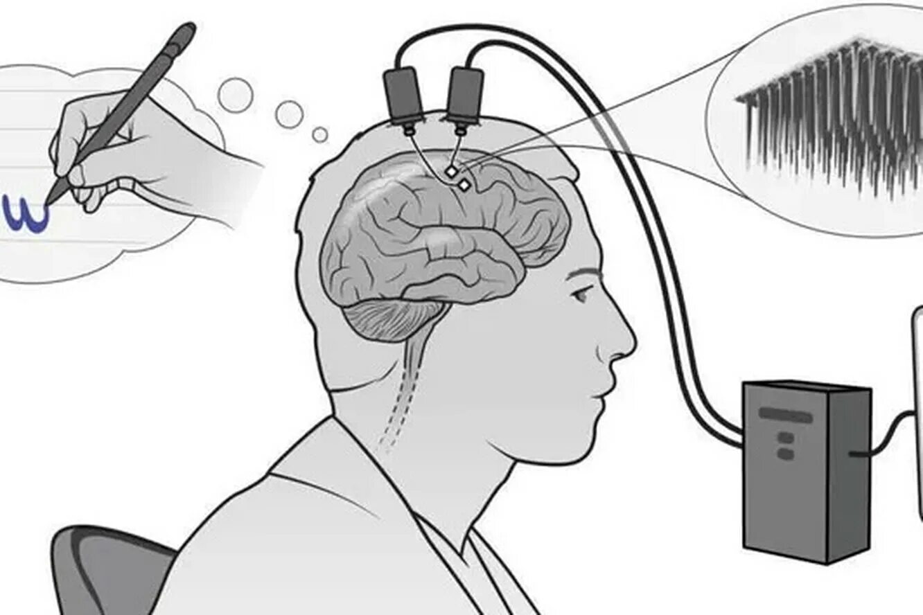 Человеческий мозг и компьютер. Нейрокомпьютерный Интерфейс. Интерфейс мозг компьютер. Нейрокомпьютерный Интерфейс в медицине. Мозг подключенный к компьютеру.