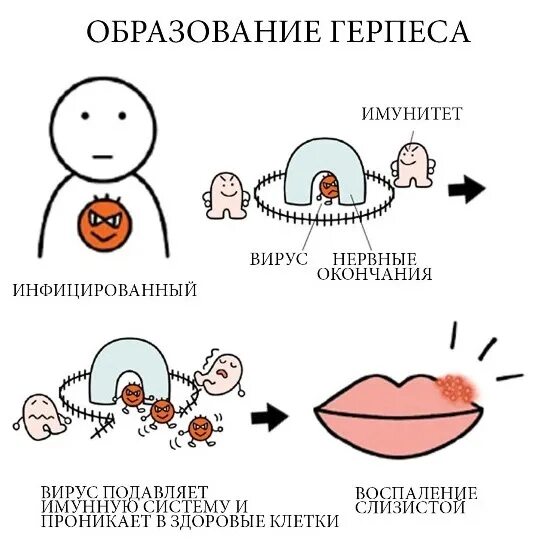 Губы во время беременности. Герпес при беременности 1 триместр последствия для малыша. герпес при беременности 2 триместр. герпес на губе при беременности 2 триместр. герпес на губе при беременности 1 триместр.