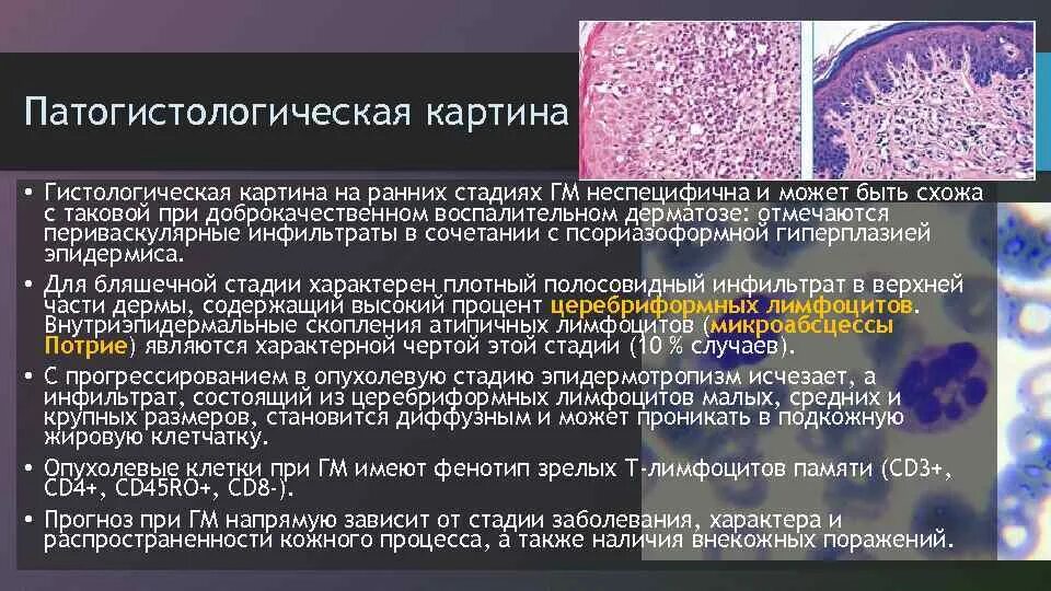 Неходжкинские лимфомы