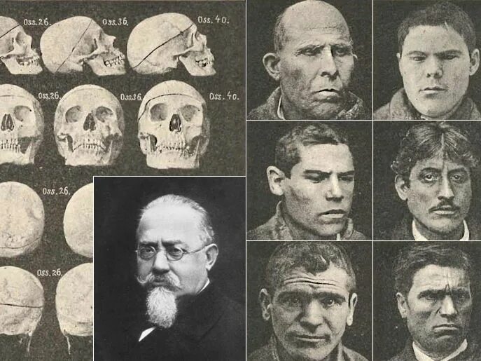 Тест ломброзо пройти тип. Теория ломброзо. признаки преступника ломброзо. типы преступников по ломброзо. чезаре ломброзо фото.