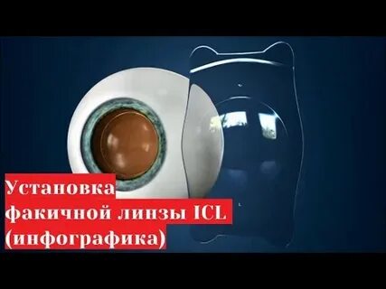 Факичной линзы отзывы