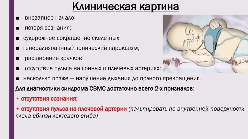 Синдром внезапной смертности. Синдром внезапной смертности. Синдром внезапной смертности. Синдром свдс. Синдром внезапной смертности.