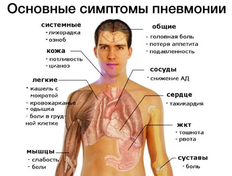 Слабость и потливость без температуры. Основные симптомы при пневмонии. Воспаление лёгких симптомы. Восполении лёгких, симптомы.