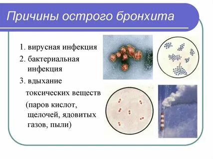 Вирусы вызывающие бронхит