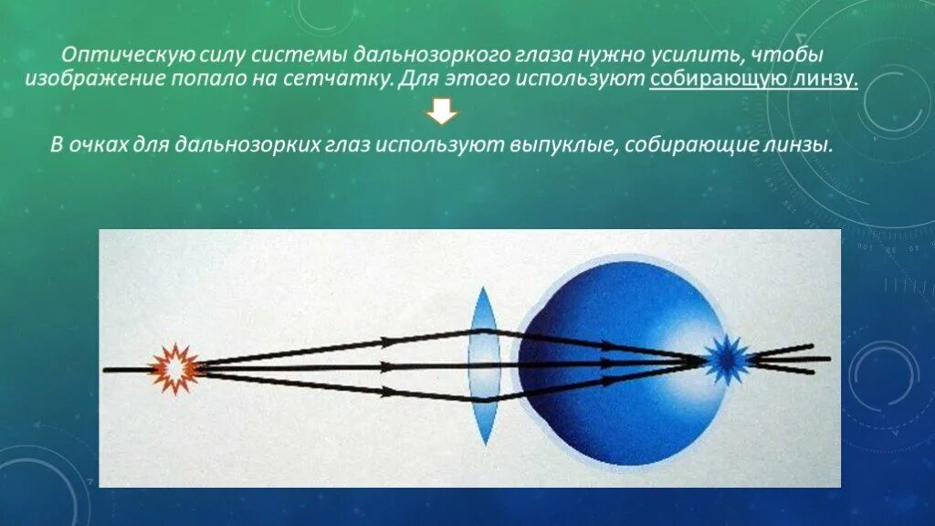 Оптическая сила дальнозоркого глаза. Глаз как оптическая система. Оптическая система человеческого глаза. Оптическая сила глаза человека. Глаз имеет оптическую силу