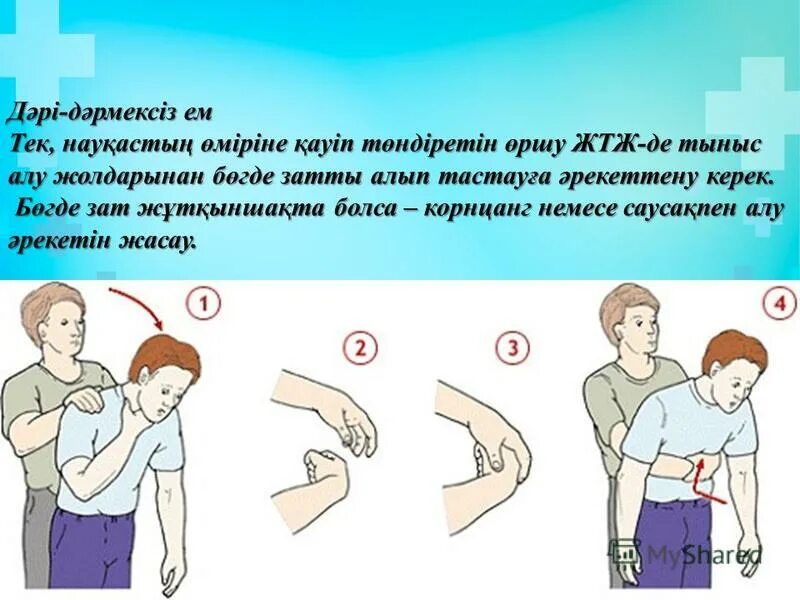 женская самооборона. приём геймлиха алгоритм. приёмы самбо для начинающих. прием геймлиха при бессознательном состоянии. основные приёмы боевого самбо.