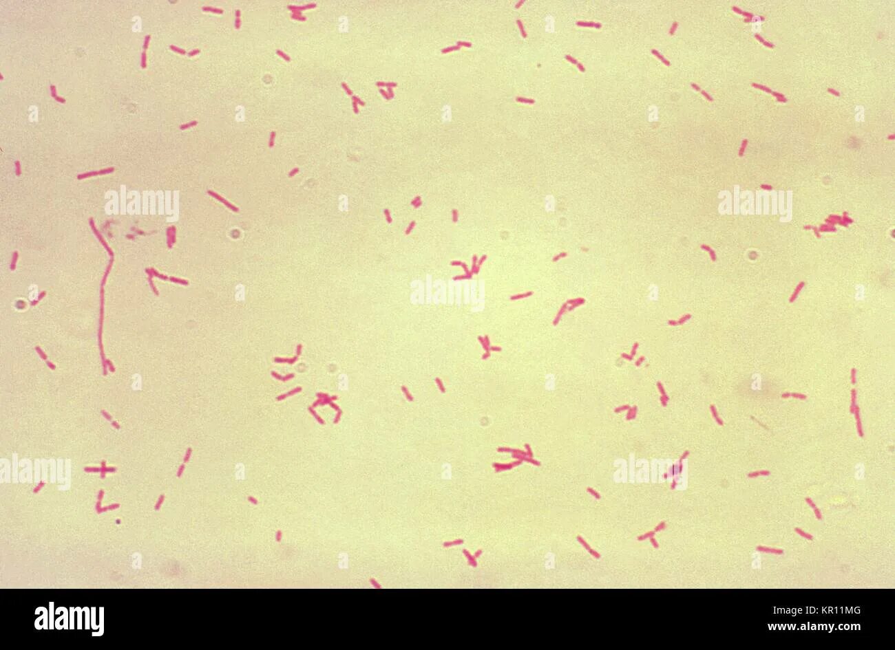 Bacteroides spp что это. Бактерии фрагилис. bacteroides fragilis микробиология. бактероиды микробиология.