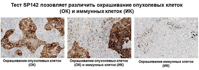 Неопределенный результат на вич. Экспрессия в опухолевых клетках что это. Простые/быстрые тесты для определения специфических антител к вич:. Полоски сателлит пкгэ-02. Ответы теста в пятерочке на должность директора.