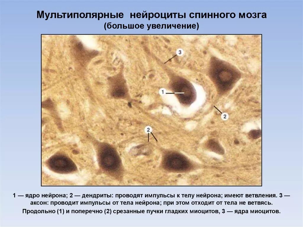 Нервные клетки спинного мозга гистология. Мультиполярные Нейроны спинного мозга препарат. Спинной мозг импрегнация серебром препарат. Мультиполярный Нейрон импрегнация серебром.