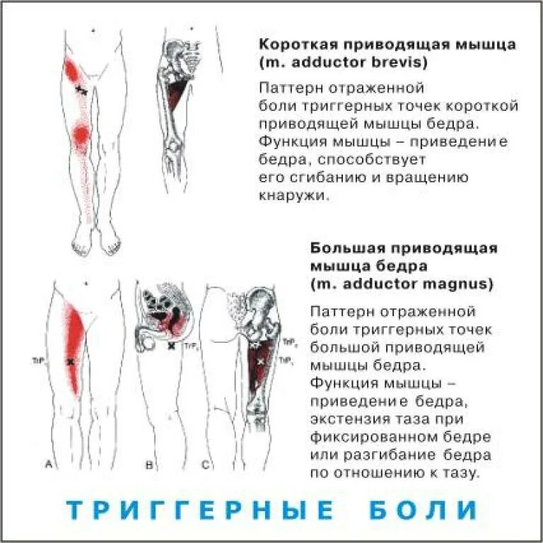 Ноет левая нога причины. Болит точка на бедре сбоку. Триггерные точки мышц ног. Болит мышца бедра. Приводящие мышцы бедра триггерные точки.