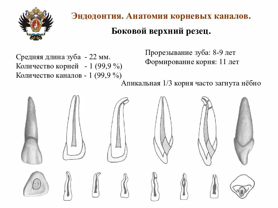 Зуб боковой резец. Верхний боковой резец анатомия каналов. Резец верхней челюсти анатомия корневых каналов. Боковой резец верхней челюсти анатомия каналы. Эндодонтия бокового резца верхней челюсти.