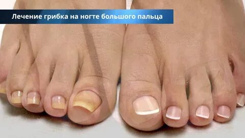 Пустота большой ноготь