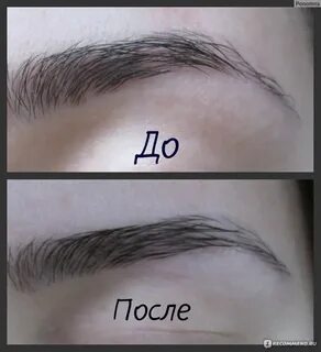 Дарсонваль для бровей