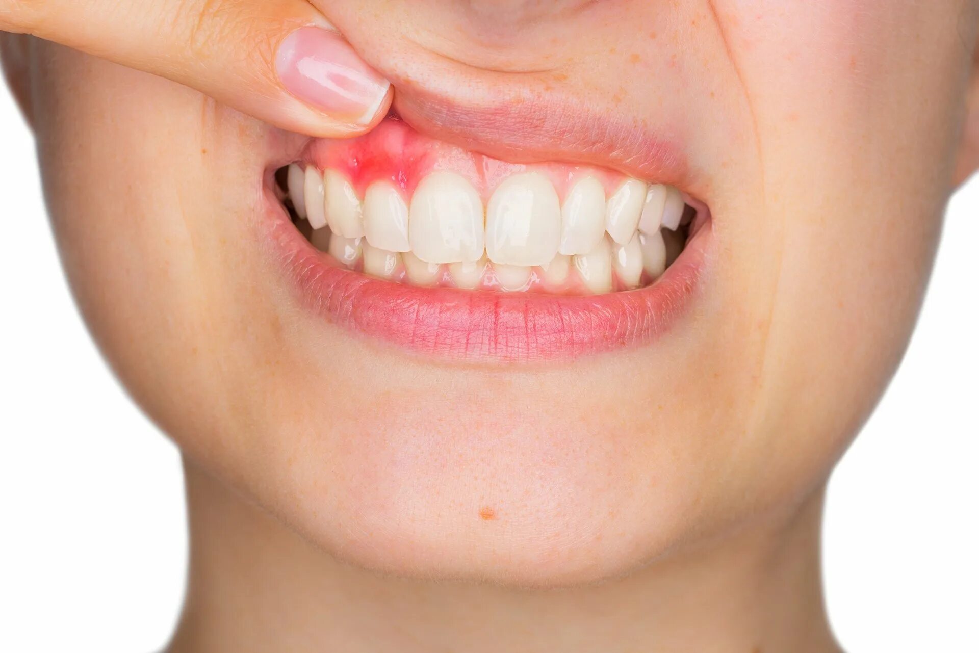 Tooth problems. Tooth problems