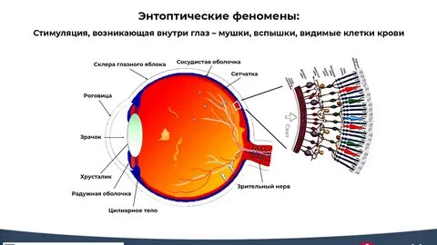 Отметьте верный вариант ответа расположено впереди сетчатки