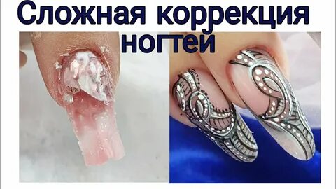Сложная коррекция
