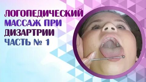 Язык при дизартрии