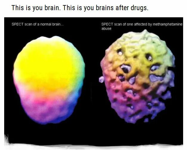 After brain. The American ad “this is your Brain on drugs”. After Brain Demo.