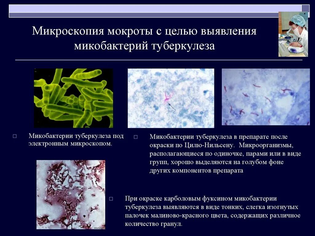 Мокрота при инфекции. Микроскопия мокроты на микобактерии. Микобактерии методы микроскопии. Методы выявления микобактерий туберкулеза в мокроте. Микроскопическое исследование мокроты на туберкулез.