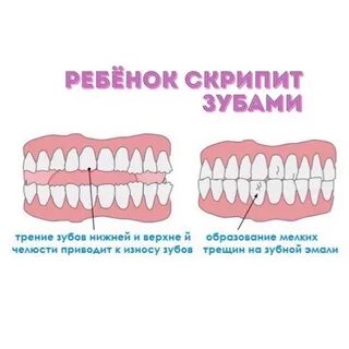 Почему скрипишь зубами во сне причины